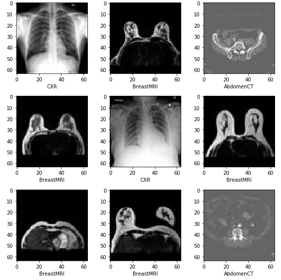 Improving Generalization of Deep AUC Maximization for Medical Image Classification